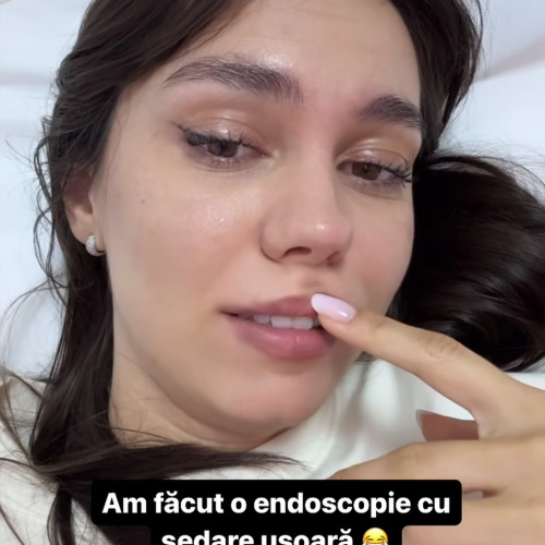 Mira, artista din Rovinari, povestește despre experiența sa cu endoscopia