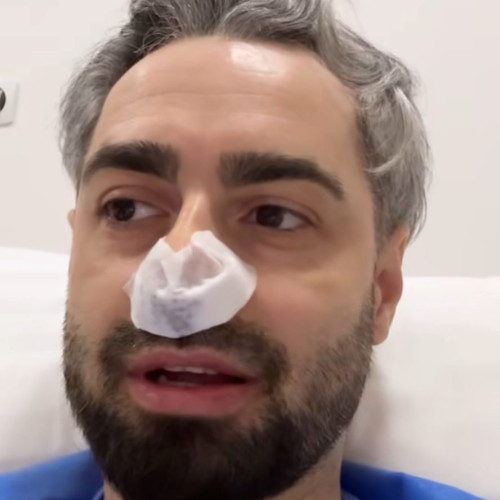 Radu Bucalae a suferit o intervenție chirurgicală la nas