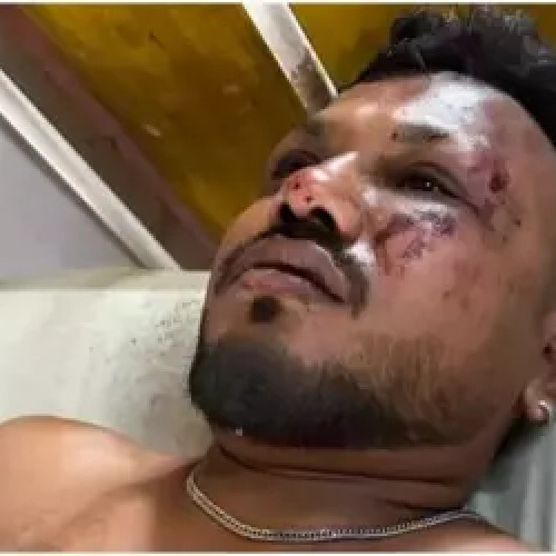 Un pasager britanic supraviețuiește după accidentul aviatic din India