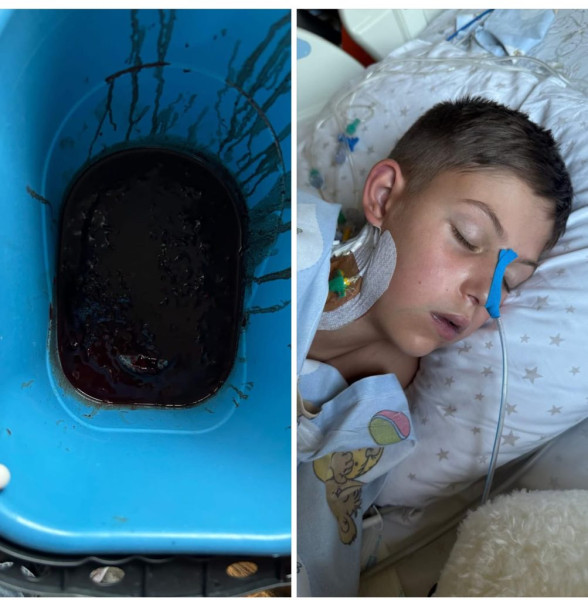 Copil de 10 ani din Petrila luptă pentru viață după hemoragii grave la inimă