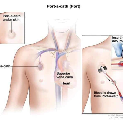 Premiera în Gorj: vești extraordinare pentru pacienții oncologici